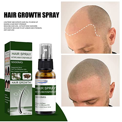 Спрей за растеж на косъма Полезните Подхранващи За Подхранване на Корените на Косата Грижа За косата Течност